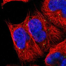FUR1 Antibody, Novus Biologicals 0.1mL; Unlabeled:Antibodies, Polyclonal