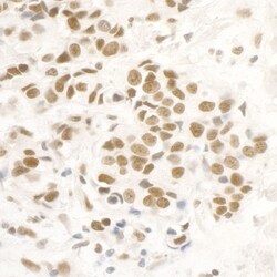 FUS Antibody, Novus Biologicals 0.1mL; Unlabeled:Antibodies