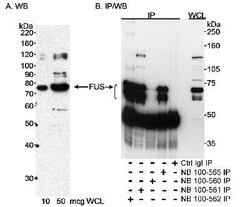 FUS Antibody, Novus Biologicals 0.1mL; Unlabeled:Antibodies