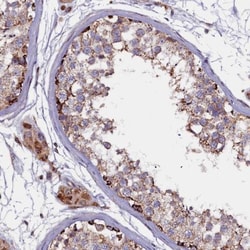 FUS2 Antibody, Novus Biologicals 25 &mu;L | Buy Online | Novus Biologicals | Fisher Scientific