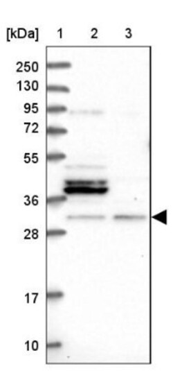 FUS2 Antibody, Novus Biologicals 25 &mu;L | Buy Online | Novus Biologicals | Fisher Scientific