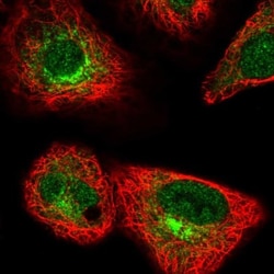 FUT10 Antibody, Novus Biologicals 0.1mL; Unlabeled:Antibodies, Polyclonal
