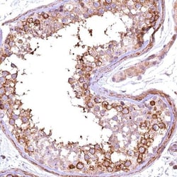 FUZ Antibody, Novus Biologicals:Antibodies:Primary Antibodies