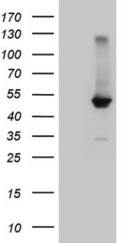 FXR/NR1H4 Antibody (OTI4F12), Novus Biologicals 0.1 mL | Buy Online | Novus Biologicals | Fisher Scientific