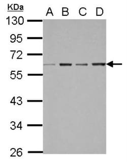 FXR/NR1H4 Antibody, Novus Biologicals 0.1mL; Unlabeled:Antibodies, Polyclonal