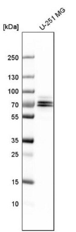 FXR1 Antibody, Novus Biologicals 0.1mL; Unlabeled:Antibodies, Polyclonal