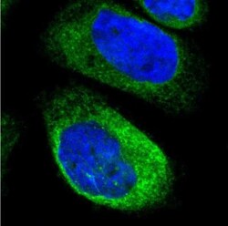 FXYD5/Dysadherin Antibody, Novus Biologicals 25 &mu;L; Unlabeled:Antibodies,