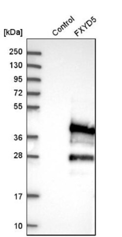 FXYD5/Dysadherin Antibody, Novus Biologicals 25 &mu;L; Unlabeled:Antibodies,