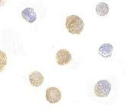 FYB/ADAP/SLAP130 Antibody - BSA Free, Novus Biologicals 0.1 mg | Buy Online | Novus Biologicals | Fisher Scientific