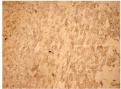 Fas/TNFRSF6/CD95 Antibody - BSA Free, Novus Biologicals 0.1 mg; Unconjugated:Antibodies,