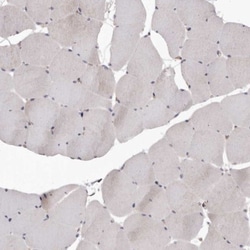 Fas/TNFRSF6/CD95 Antibody, Novus Biologicals 0.1mL; Unlabeled:Antibodies