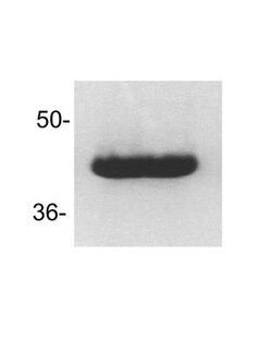 Fas/TNFRSF6/CD95 Antibody - BSA Free, Novus Biologicals 0.1 mg; Unconjugated:Antibodies,