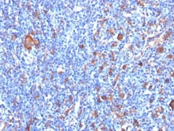 Fascin Antibody (FSCN1/417), Novus Biologicals 0.2mg; Unlabeled:Antibodies,