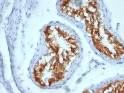 Fascin Antibody (FSCN1/417), Novus Biologicals 0.2mg; Unlabeled:Antibodies,