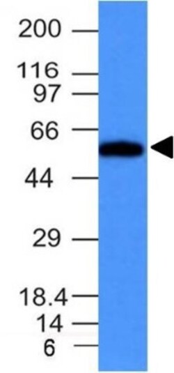 Fascin Antibody (FSCN1/417), Novus Biologicals 0.2mg; Unlabeled:Antibodies,