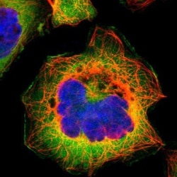 Fatty Acid Synthase/FASN Antibody, Novus Biologicals:Antibodies:Primary