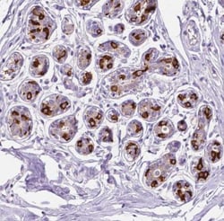 Fatty Acid Synthase/FASN Antibody, Novus Biologicals:Antibodies:Primary