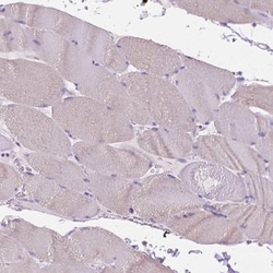 Fatty Acid Synthase/FASN Antibody, Novus Biologicals:Antibodies:Primary