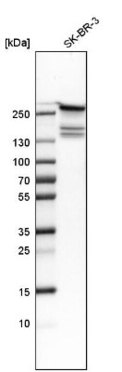 Fatty Acid Synthase/FASN Antibody, Novus Biologicals:Antibodies:Primary