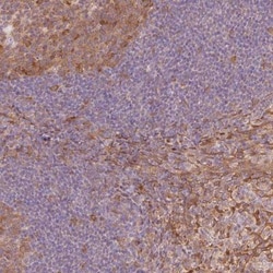Fbl14 Antibody, Novus Biologicals 25 &mu;L, Unlabeled:Antibodies, Polyclonal