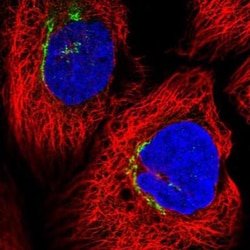 Fbxl8 Antibody, Novus Biologicals 0.1mL; Unlabeled:Antibodies, Polyclonal