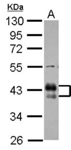 Fc gamma RIIB/CD32b Antibody, Novus Biologicals 0.1mL; Unlabeled:Antikörper