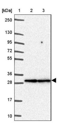 Fc gamma RIIIA/CD16a Antibody, Novus Biologicals:Antibodies:Primary Antibodies