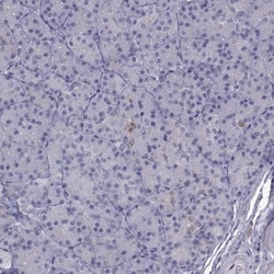Ferredoxin Reductase Antibody, Novus Biologicals 25 &mu;L, Unlabeled:Antibodies,