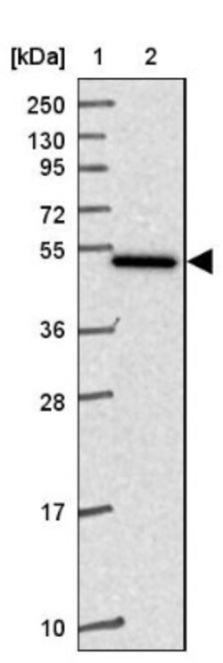Ferredoxin Reductase Antibody, Novus Biologicals 0.1mL; Unlabeled:Antibodies,