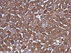 Ferritin Heavy Chain Antibody, Novus Biologicals 0.1mL; Unlabeled:Antibodies,