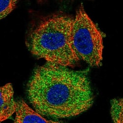 Ferritin Light Chain Antibody, Novus Biologicals:Antibodies:Primary Antibodies