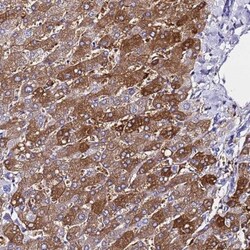 Ferritin Light Chain Antibody, Novus Biologicals:Antibodies:Primary Antibodies