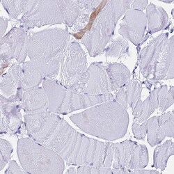 Ferritin Light Chain Antibody, Novus Biologicals:Antibodies:Primary Antibodies