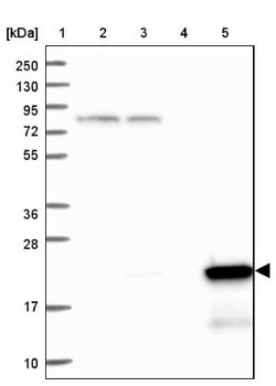 Ferritin Light Chain Antibody, Novus Biologicals:Antibodies:Primary Antibodies