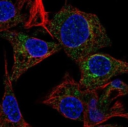 Fetuin A/AHSG Antibody, Novus Biologicals:Antibodies:Primary Antibodies