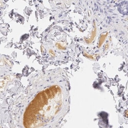 Fetuin A/AHSG Antibody, Novus Biologicals 0.1mL; Unlabeled:Antibodies,