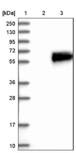 Fetuin A/AHSG Antibody, Novus Biologicals 0.1mL; Unlabeled:Antibodies,