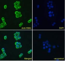 Fibrillin 1 Antibody, Novus Biologicals 0.1mg; Unlabeled:Antibodies, Polyclonal