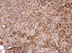 Fibrinogen beta chain Antibody, Novus Biologicals 0.1mL; Unlabeled:Antibodies,