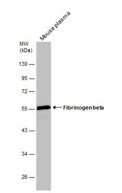 Fibrinogen beta chain Antibody, Novus Biologicals 0.1mL; Unlabeled:Antibodies,