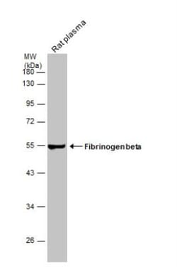 Fibrinogen beta chain Antibody, Novus Biologicals 0.1mL; Unlabeled:Antibodies,