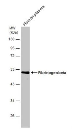 Fibrinogen beta chain Antibody, Novus Biologicals 0.1mL; Unlabeled:Antibodies,