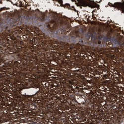 Fibulin 1 Antibody, Novus Biologicals 0.1mL; Unlabeled:Antibodies, Polyclonal