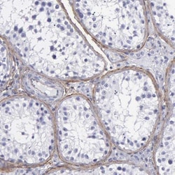 Fibulin 5/DANCE Antibody, Novus Biologicals 25 &mu;L | Buy Online | Novus Biologicals | Fisher Scientific