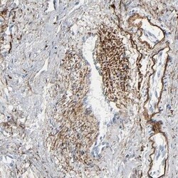 Fibulin 5/DANCE Antibody, Novus Biologicals:Antibodies:Primary Antibodies