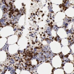 Ficolin-1 Antibody, Novus Biologicals 0.1mL; Unlabeled:Antibodies, Polyclonal