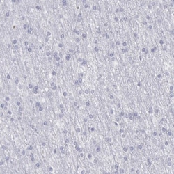 Ficolin-1 Antibody, Novus Biologicals 0.1mL; Unlabeled:Antibodies, Polyclonal