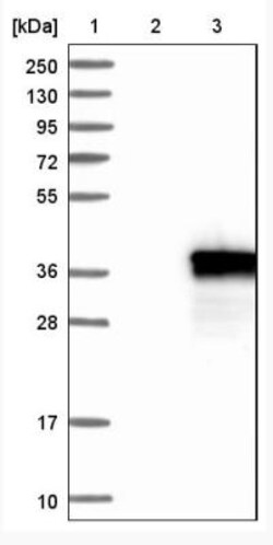 Ficolin-1 Antibody, Novus Biologicals 0.1mL; Unlabeled:Antibodies, Polyclonal