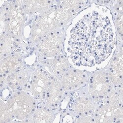 Filaggrin Antibody, Novus Biologicals 25 &mu;L | Buy Online | Novus Biologicals | Fisher Scientific