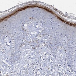 Filaggrin Antibody, Novus Biologicals 25 &mu;L | Buy Online | Novus Biologicals | Fisher Scientific